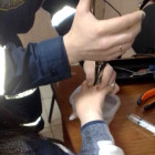 В Пензе кольцо с пальца женщины пришлось срезать спасателям