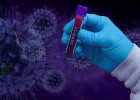 В Пензенской области выросла заболеваемость COVID-19