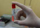 В Пензенской области за сутки выявлено 428 новых случаев коронавируса