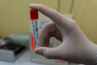В Пензенской области за сутки выявлено 428 новых случаев коронавируса