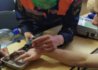 В Пензе кольцо с пальца мужчины снимали с помощью спасателей
