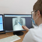 Пятерым жителям Пензенской области впервые диагностировали туберкулез в 2023 году 